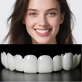 Facetas Dentárias Removíveis SorrisoFlex