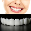 Facetas Dentárias Removíveis SorrisoFlex